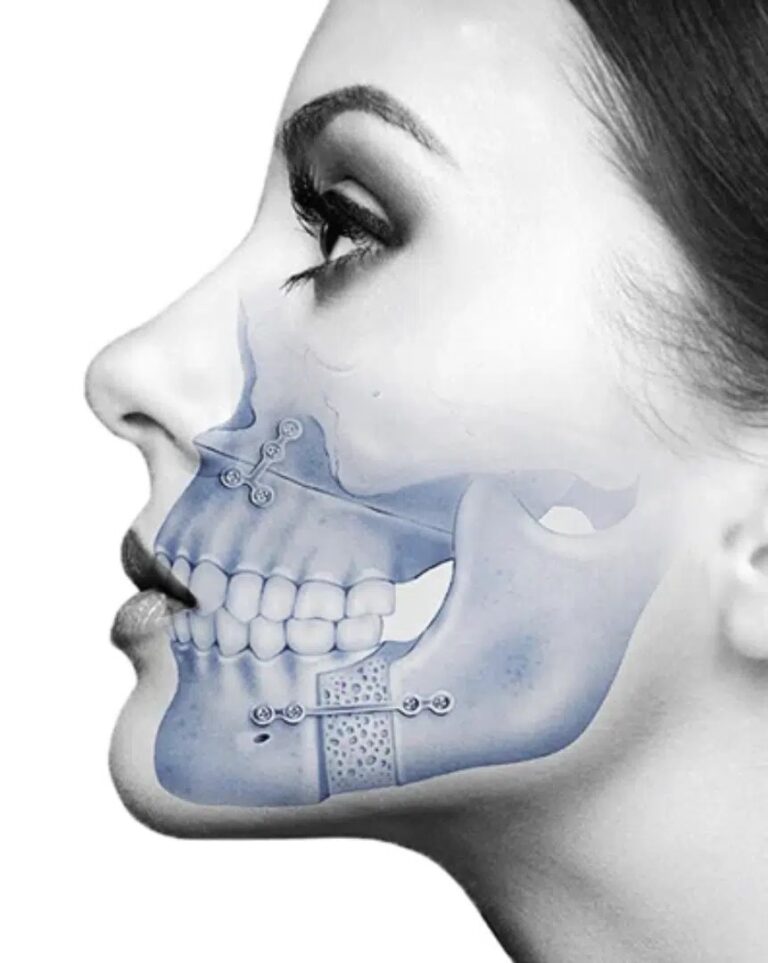 Maxillofacial Surgery