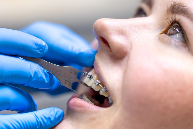 Orthodontics